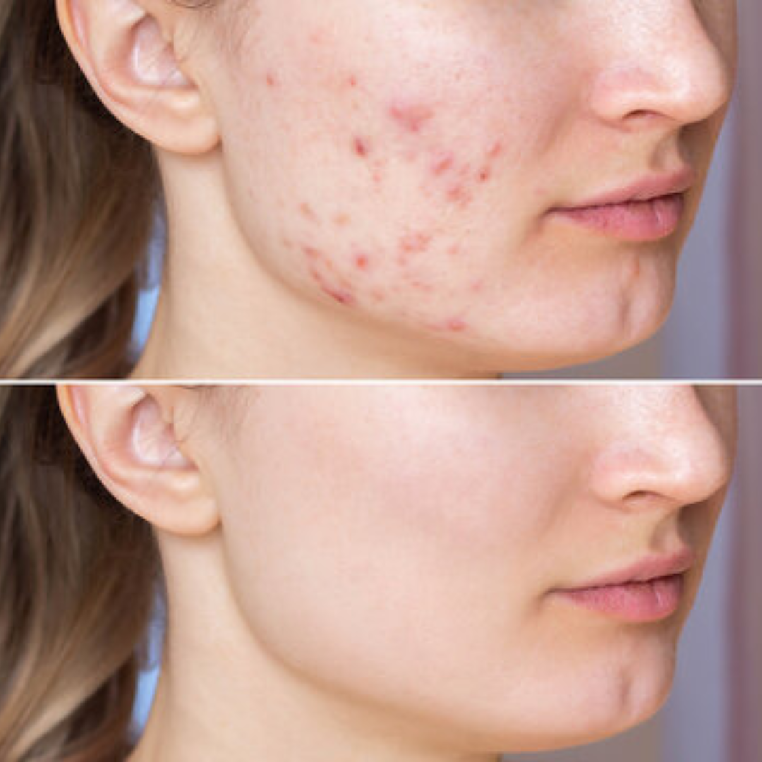 Laniska Scar Soothing Cream | 7-in-1 Skin Repair with Argan Oil