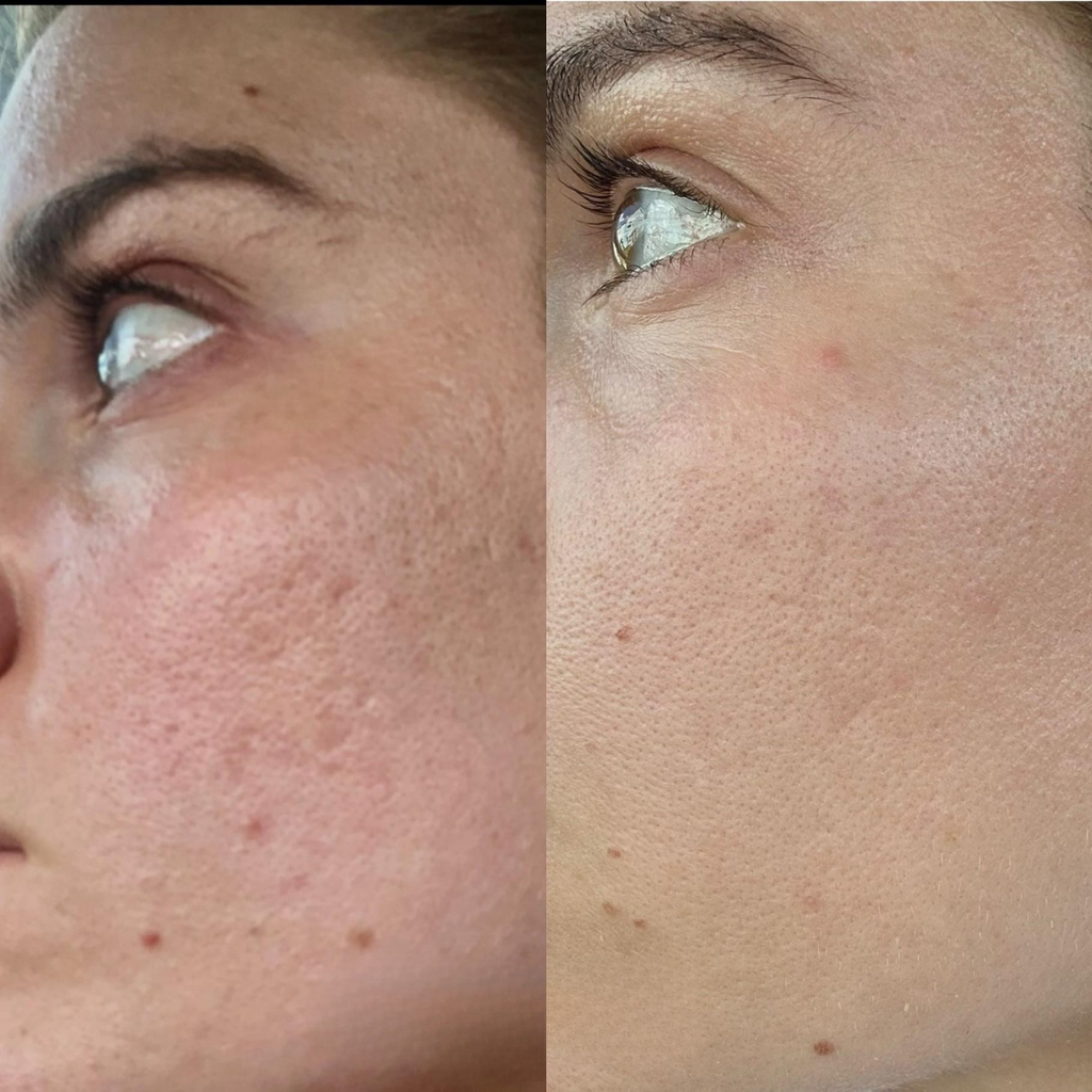 Laniska Scar Soothing Cream | 7-in-1 Skin Repair with Argan Oil
