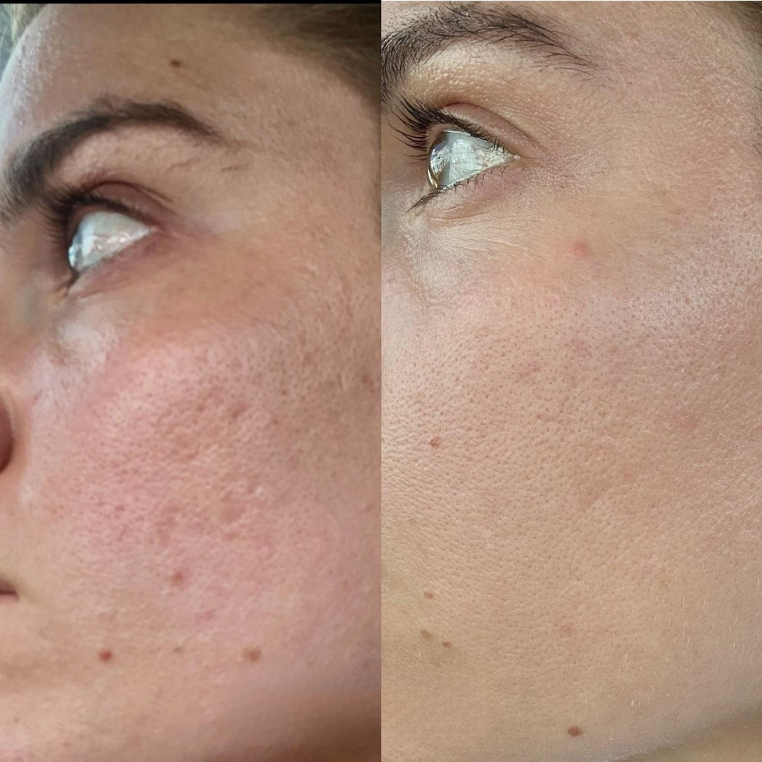 Laniska Scar Soothing Cream | 7-in-1 Skin Repair with Argan Oil