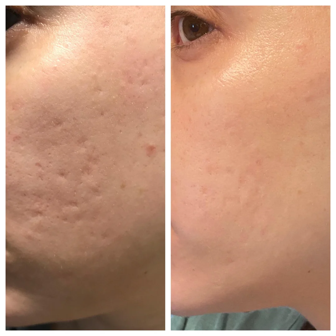 Laniska Scar Soothing Cream | 7-in-1 Skin Repair with Argan Oil