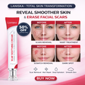 Laniska Scar Soothing Cream | 7-in-1 Skin Repair with Argan Oil